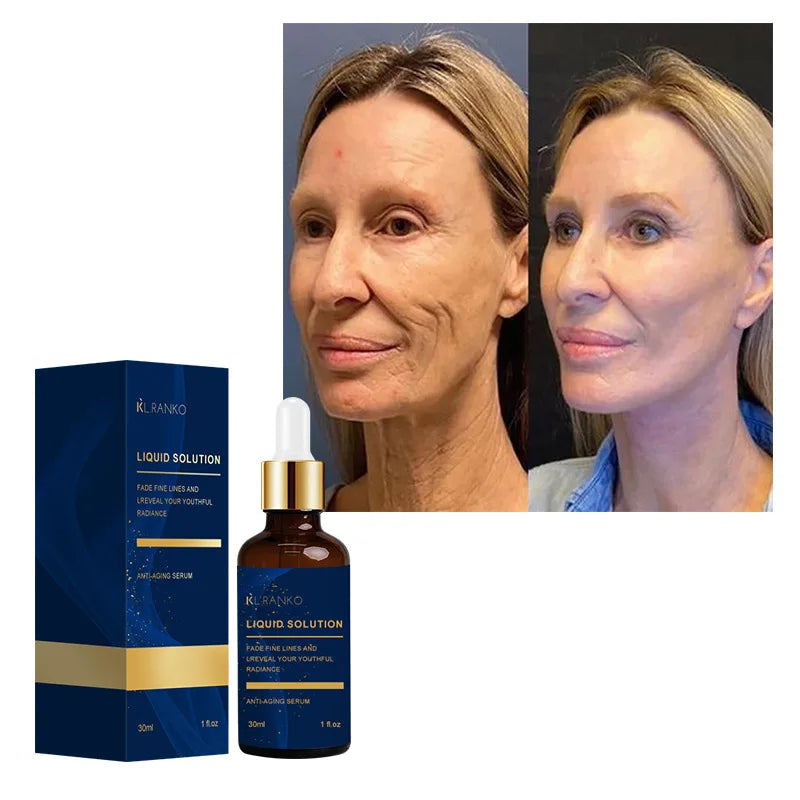 Highly Effective Niacinamide Formula Significantly Reduces Spots And Acne Scars, Making Skin More Even And Translucent 30ml