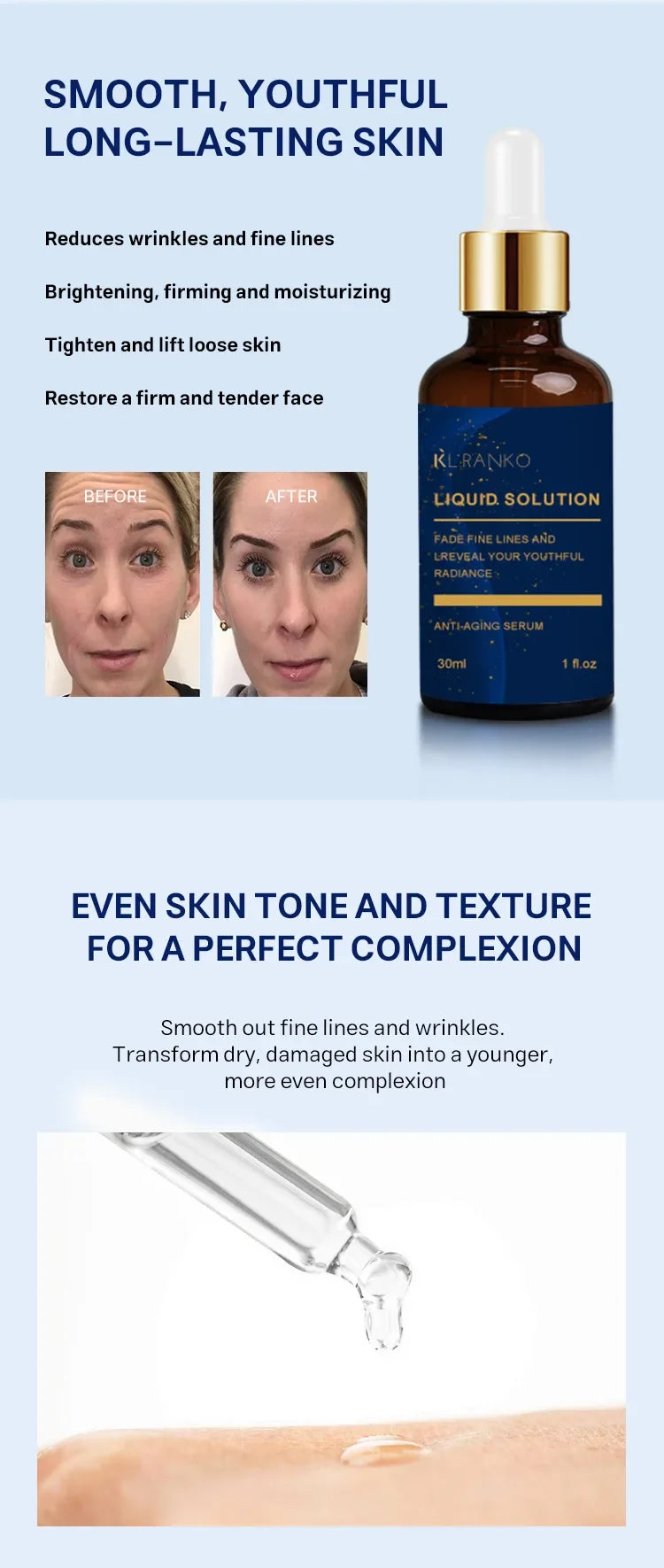 Highly Effective Niacinamide Formula Significantly Reduces Spots And Acne Scars, Making Skin More Even And Translucent 30ml